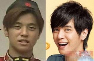 男整容前后照片,揭秘男星整容前后惊人对比